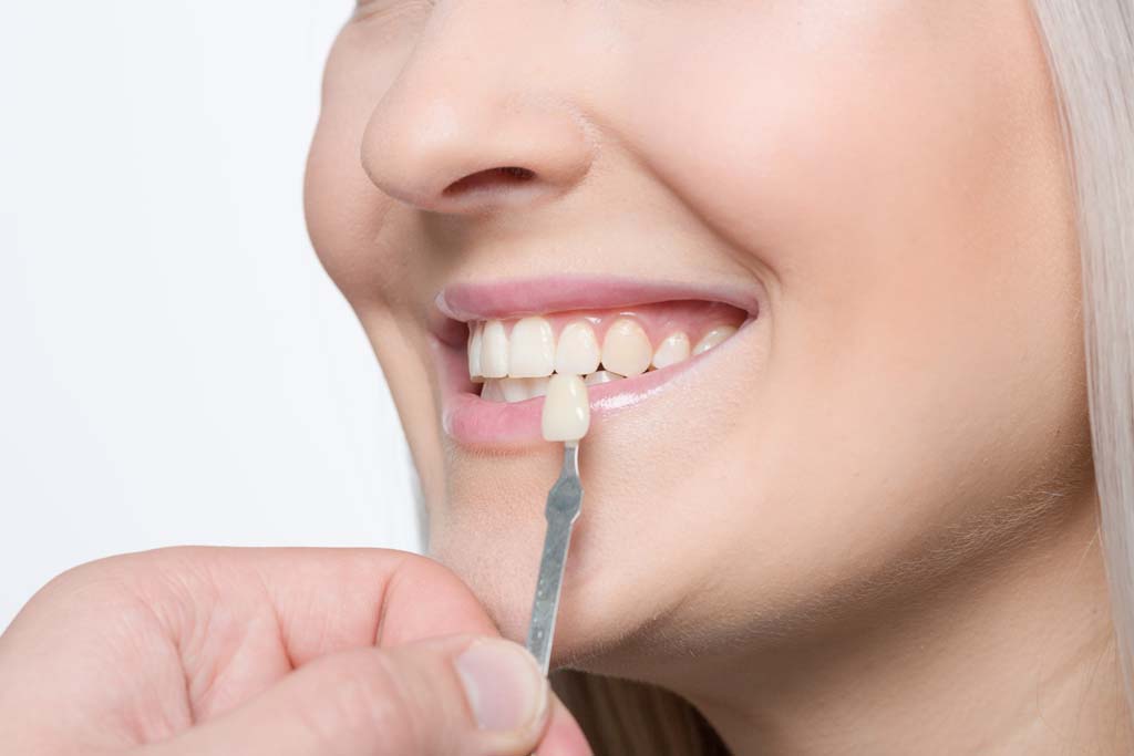Clínica Dental Cartagena - Clínica Dental Vidal