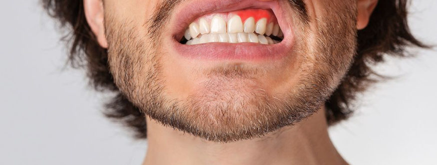 Clínica Dental Cartagena - Clínica Dental Vidal