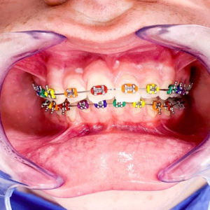 Clínica Dental Cartagena - Clínica Dental Vidal