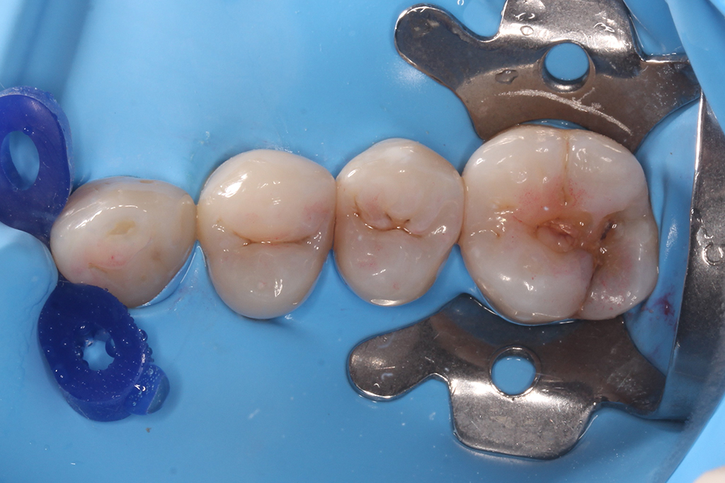 Clínica Dental Cartagena - Clínica Dental Vidal